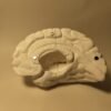 El Cerebro Humano