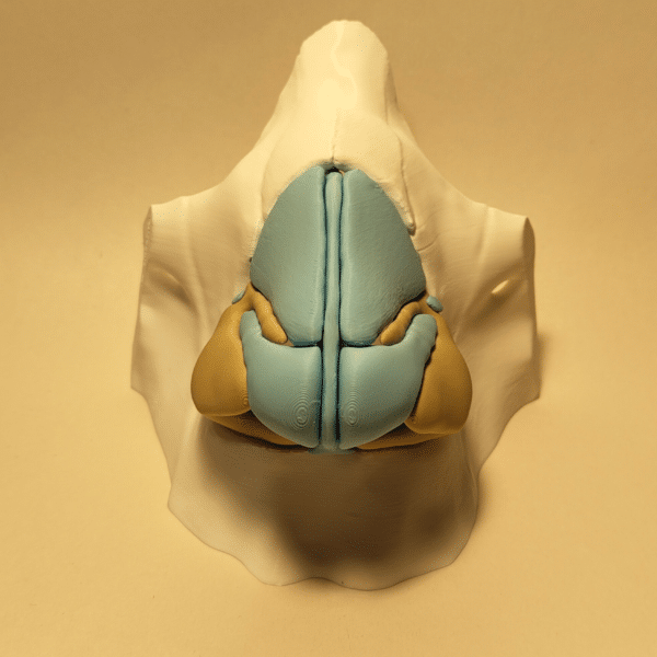 Vista lateral de un modelo de nariz mostrando el cartílago y el hueso nasal, ideal para planificación quirúrgica estética.