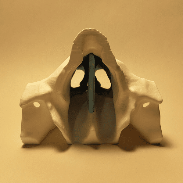 Corte sagital de un modelo anatómico destacando en color amarillo el bulbo olfatorio y las terminaciones nerviosas en la cavidad nasal superior.