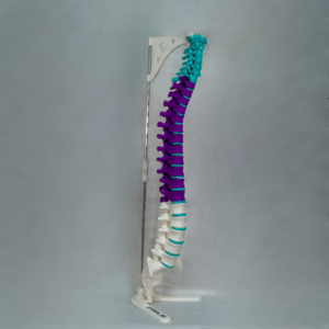 columna-vertebral-color-yoam3d Columna Vertebral