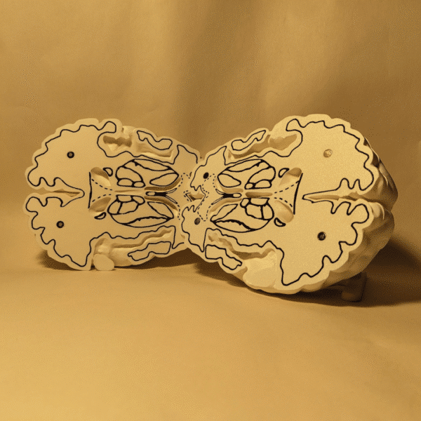 Set de piezas anatómicas blancas representando el tálamo, el caudado y otros núcleos internos, separados sobre una mesa de estudio.