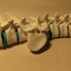 Vertebra Escoliosis