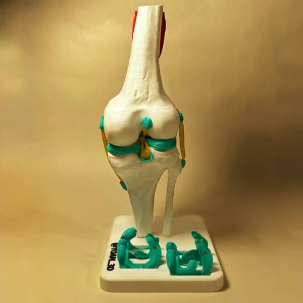 Modelo anatómico de alta fidelidad de la rodilla derecha, vista trasera, utilizado para demostración clínica de lesiones