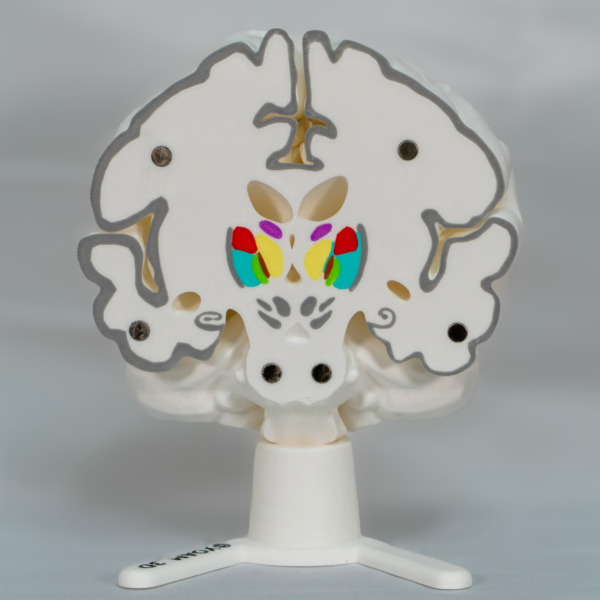Edición coleccionista a color de la maqueta cerebro y cerebro desmontable de YOAM 3D