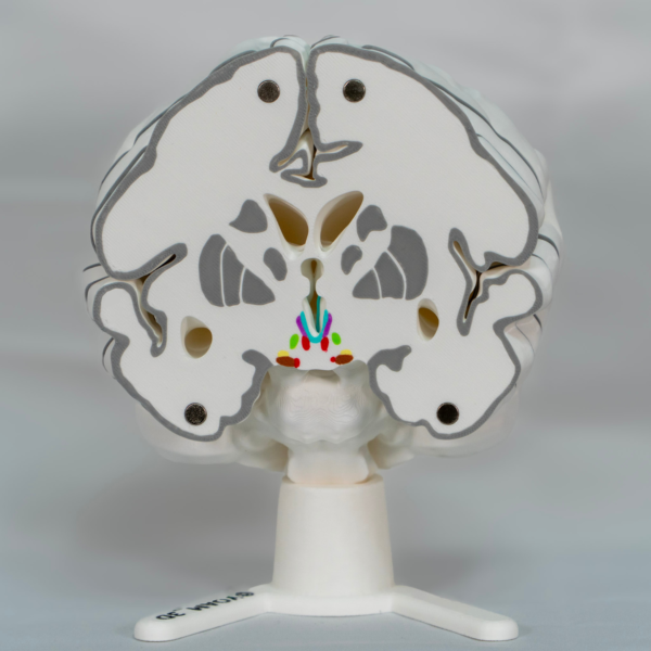 Vista lateral de la maqueta de cerebro, destacando entre los cerebros maqueta por su nivel de detalle a color