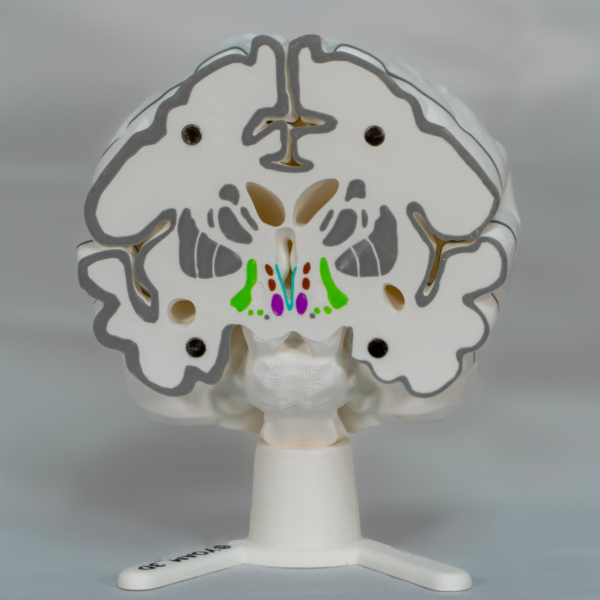 Relación espacial anatómica que muestra el hueso cerebro integrado en la maqueta del cerebro