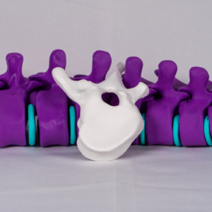 modelo-anatomico-escoliosis-vertebra-yoam Maqueta didáctica en formato blanco para analizar visualmente la escoliosis anatomía y marcar sus efectos sobre la vértebra.