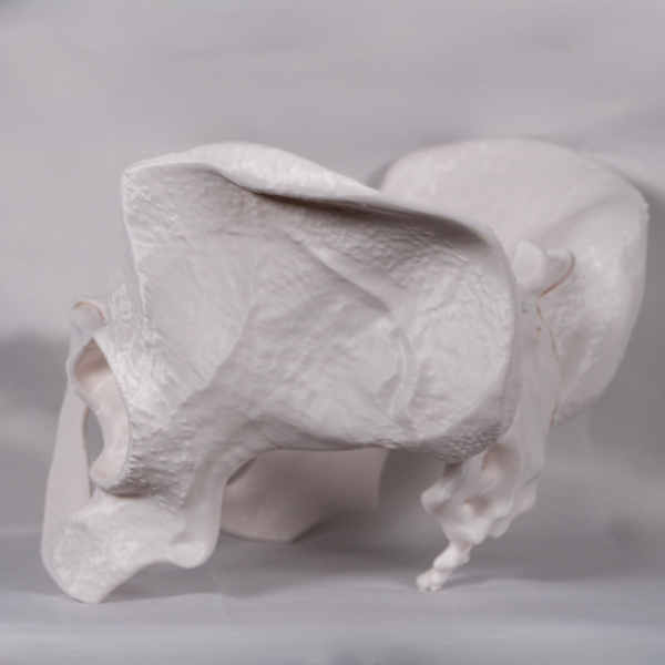 rotura-de-pelvis-fractura-de-pelvis-estudio Modelo anatómico para explorar la relación entre caderas y pelvis y la pelvis anatomia general.