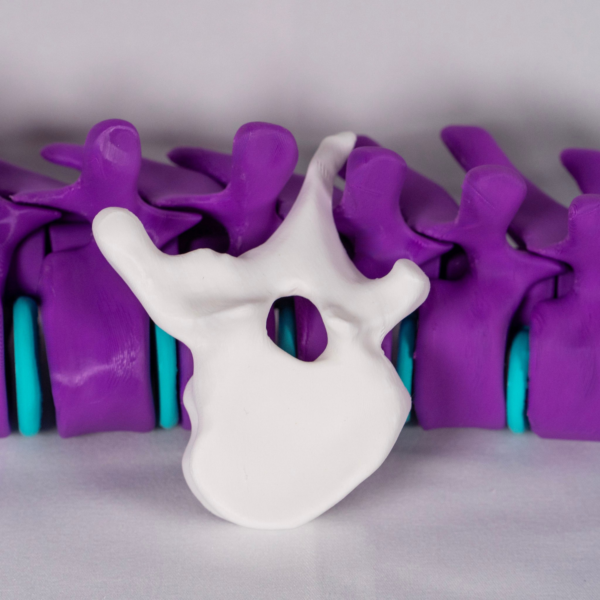 vertebra-3d-escoliosis-anatomia Maqueta de una vértebra con escoliosis en blanco, diseñada para estudiar de forma práctica la anatomía de la escoliosis.